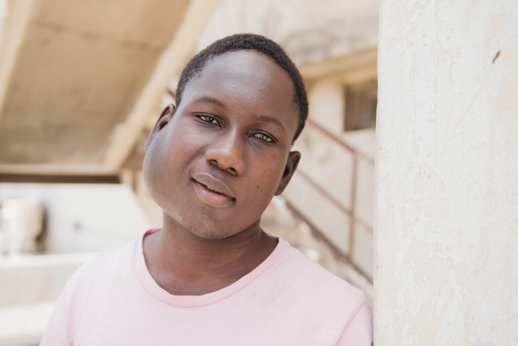 Cire, tumour patient, on day of admission with melon-sized tumour on side of his face. 