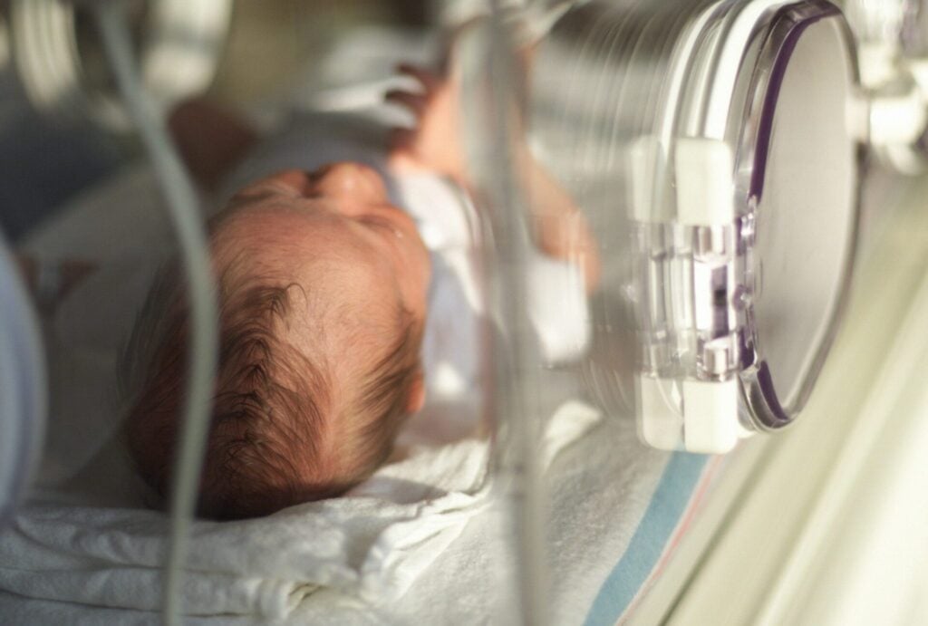 Newborn preemie in incubator, delicate care.