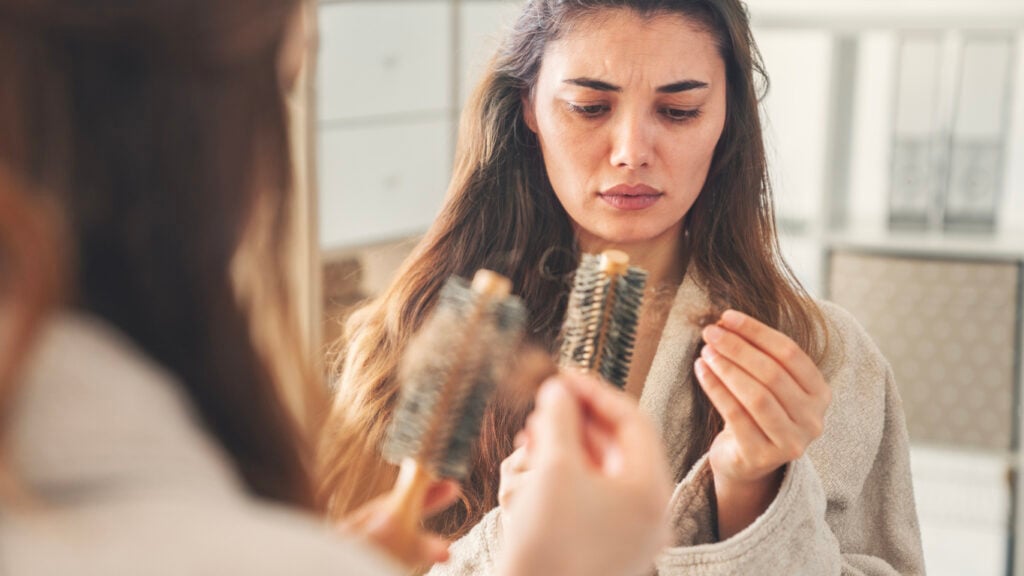 Young woman with hair loss problems